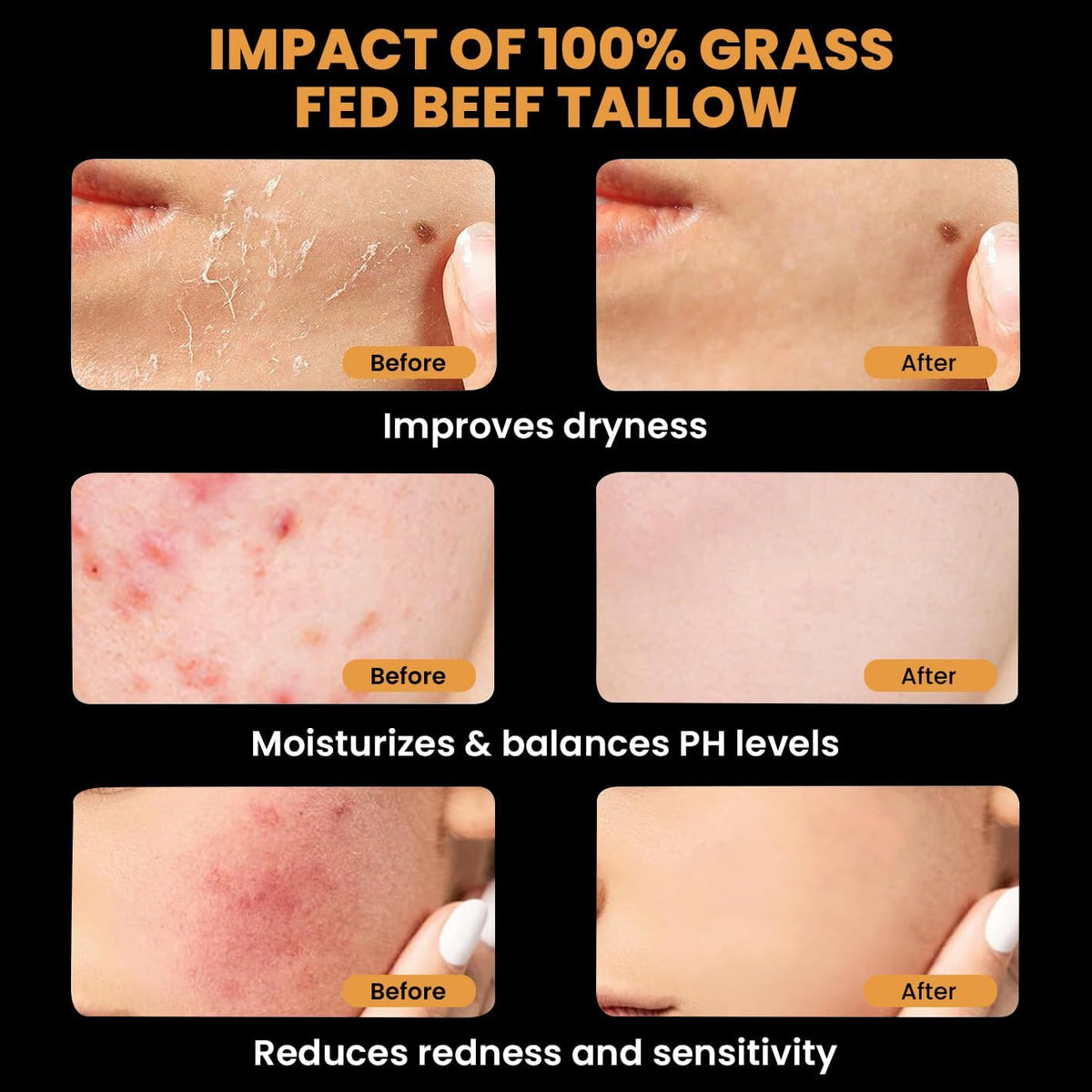 MONIER balm being warmed on hand to show easy application and quick absorption