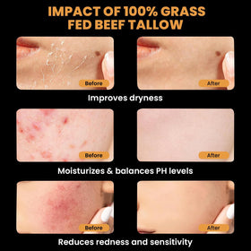 MONIER balm being warmed on hand to show easy application and quick absorption