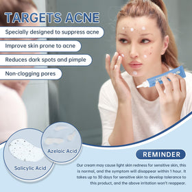 mopayzer applied on hand demonstrating smooth spread and calming effect on skin