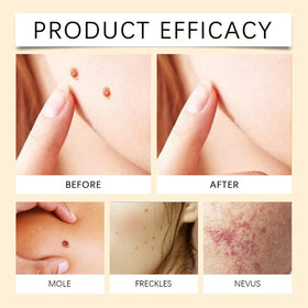 MORKORIA on bathroom vanity with towel showing everyday at-home treatment benefit