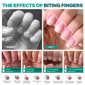Morovan applied to a child’s thumbnail demonstrating easy use