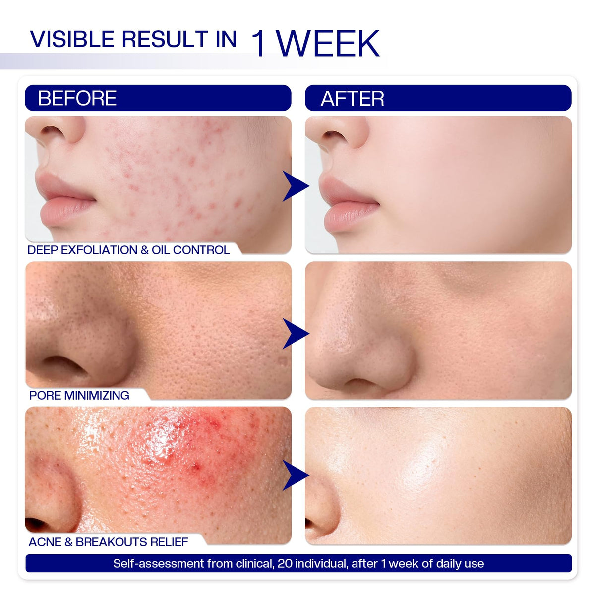 Morovan pad in hand to demonstrate size and easy single-use handling