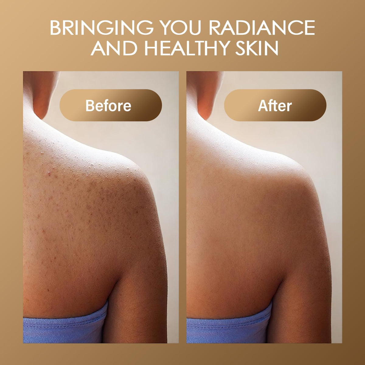 MOSRROU used on bikini area showing gentle, targeted exfoliation