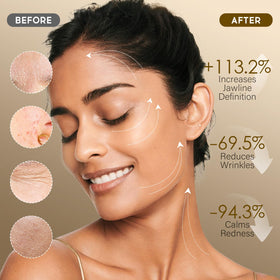 MOSRROU ingredient label close-up emphasizing collagen and hyaluronic acid