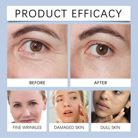 MUBSEOTH Olavita before and after comparison mockup illustrating smoother skin appearance