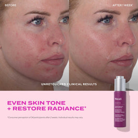 Bilberry seeds and oil visual, Murad ingredient highlight for essential omegas