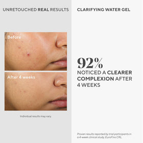Murad clarifying water gel texture closeup displays lightweight hydration