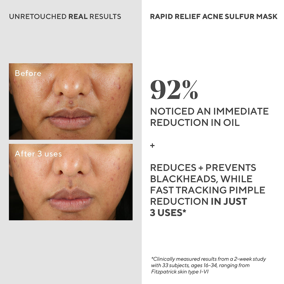Murad rinsing mask with water illustrating easy removal and gentle exfoliation benefit