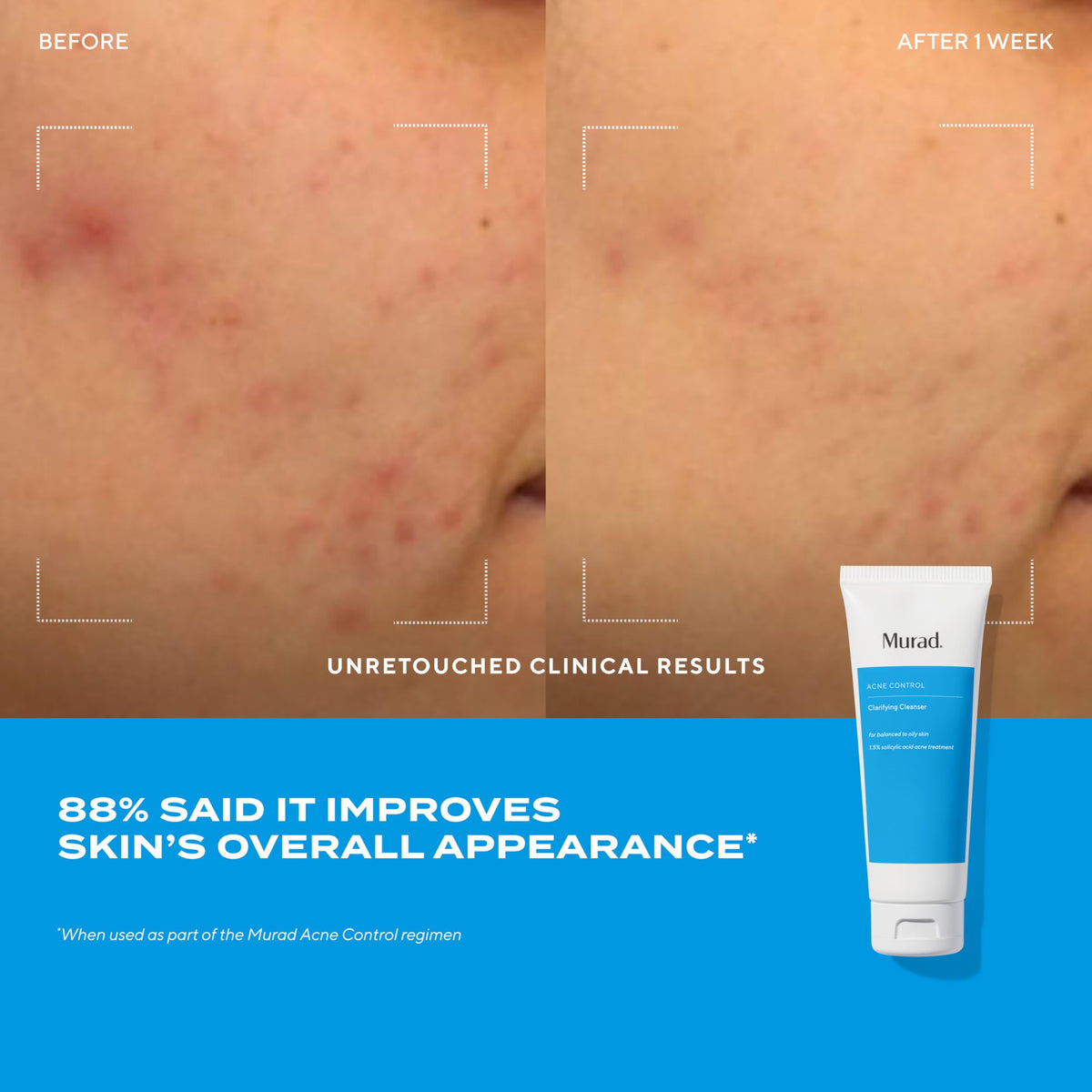 Murad oil-control moisturizer tube top view illustrating lightweight mattifying hydration