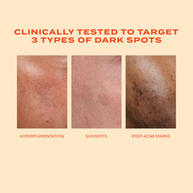 Murad before and after visual comparison showing reduced spot appearance