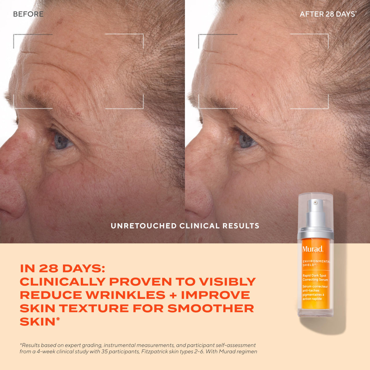 Murad pump dispensing serum onto fingertip for controlled application