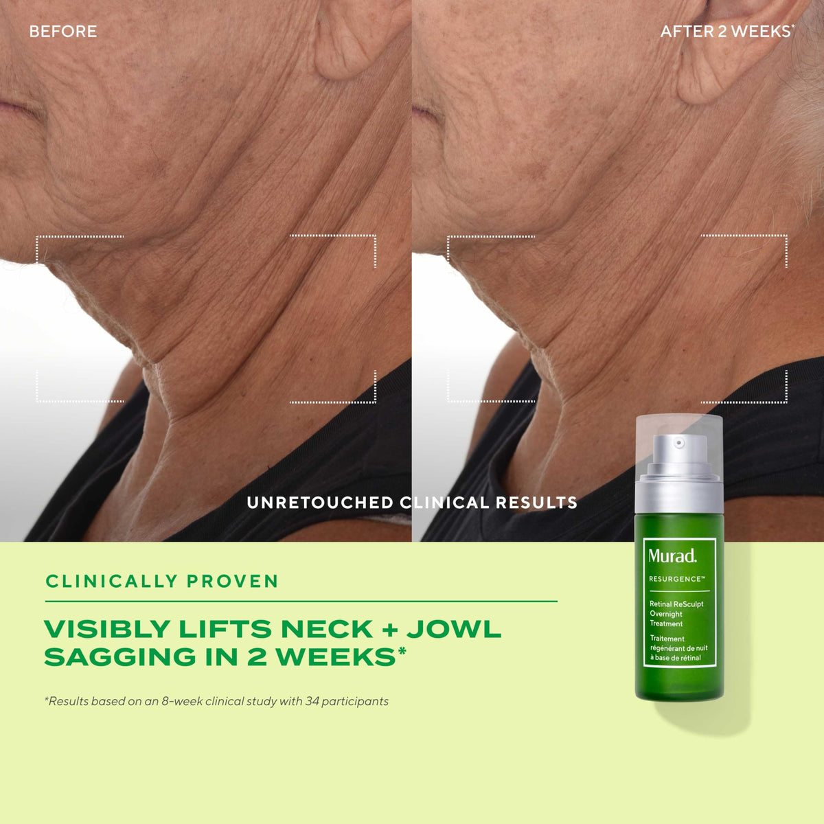 Murad bottle label close-up showing product name and active ingredients for clarity