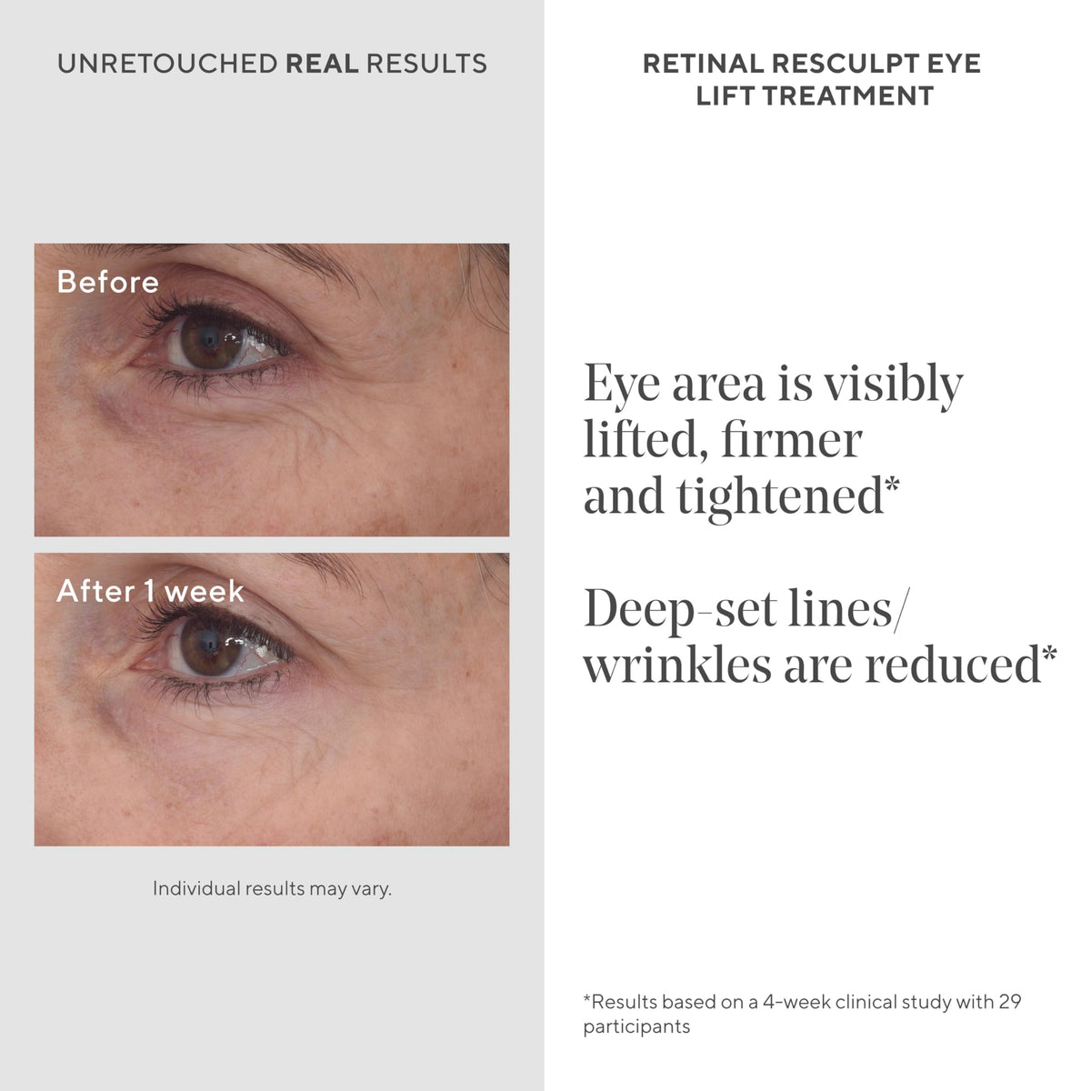 Murad Retinal ReSculpt cream texture close-up highlighting lightweight, non-greasy finish