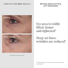 Murad Retinal ReSculpt cream texture close-up highlighting lightweight, non-greasy finish