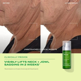 Kangaroo paw, olive, and oat beside Murad product showing botanical support