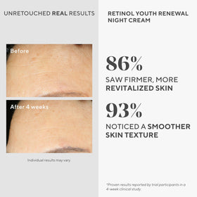 Murad open jar top view revealing smooth night cream for overnight repair