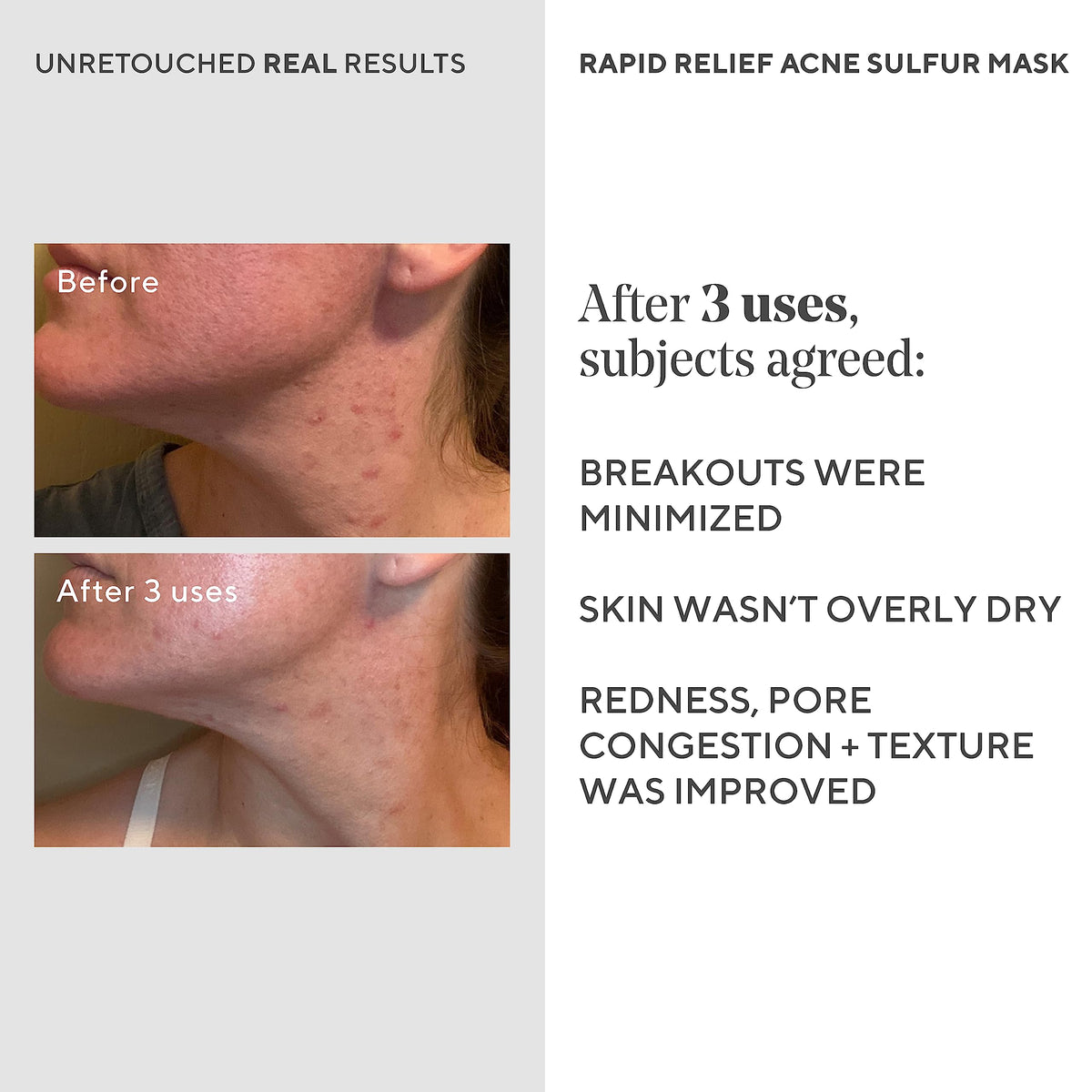 Murad closeup of tube label and ingredients showing active acids and clarity benefit