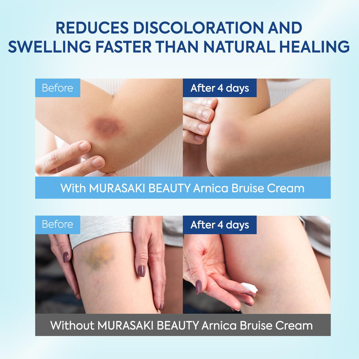 MURASAKI BEAUTY two-pack box and tubes for extended use