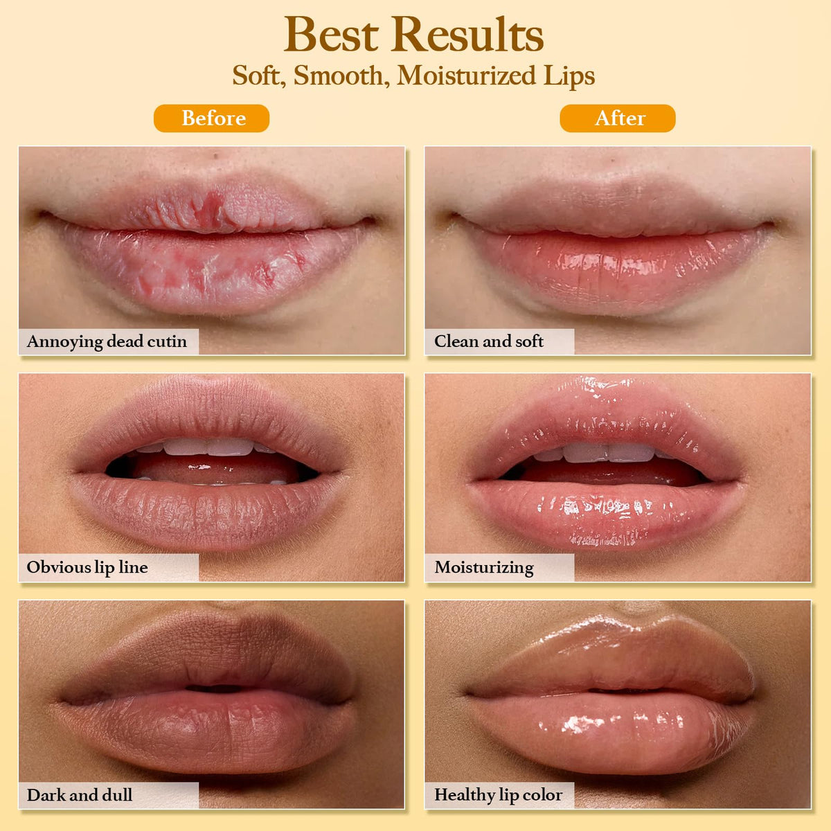 MUREND before and after lips comparison illustrating improved texture and smoother appearance