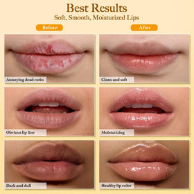 MUREND before and after lips comparison illustrating improved texture and smoother appearance
