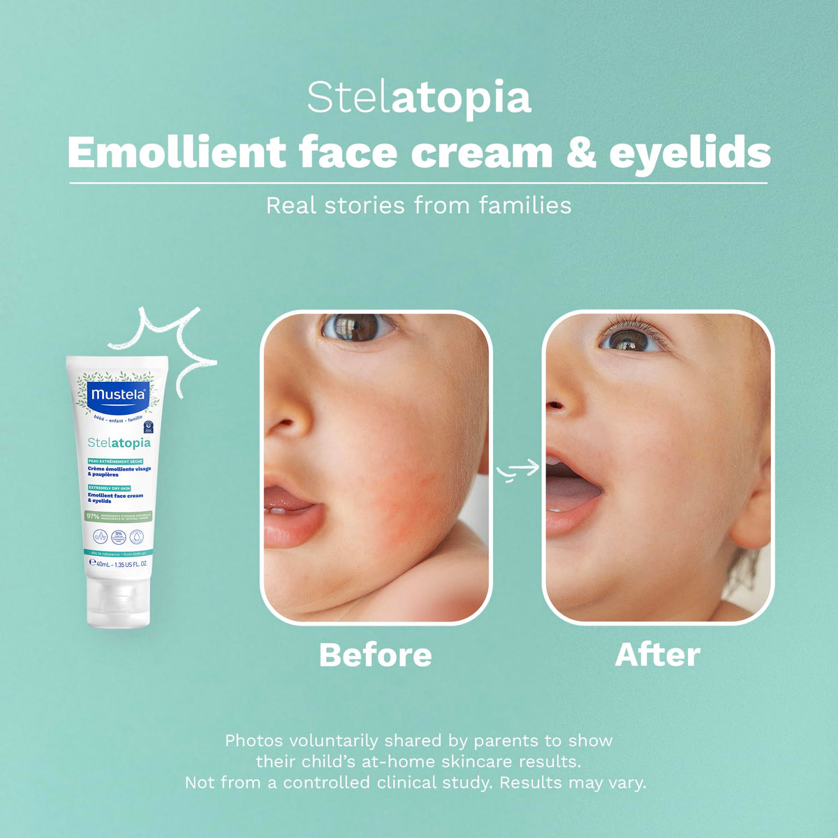 Mustela Stelatopia applied to baby cheek for soothing and hydration