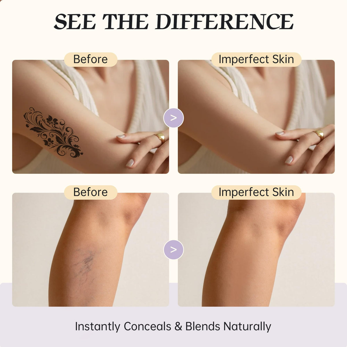 MyTend application before-and-after on arm showing tattoo concealment
