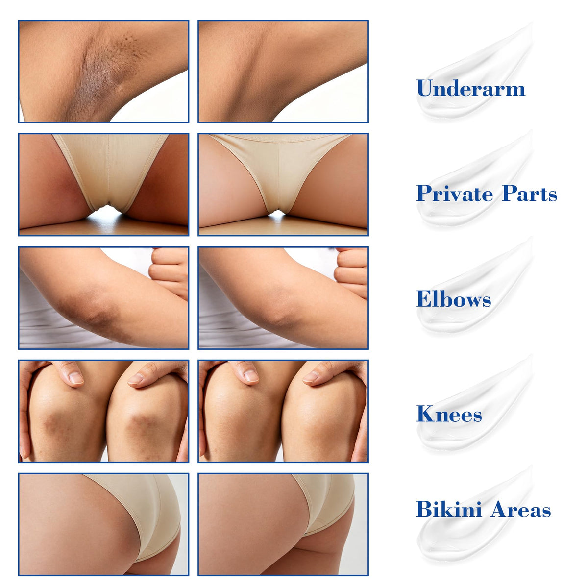MyTend underarm before-and-after visual indicating brighter, even tone potential