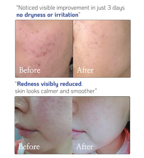 Nano Recipe mixed into serum in palm illustrating easy blending benefit