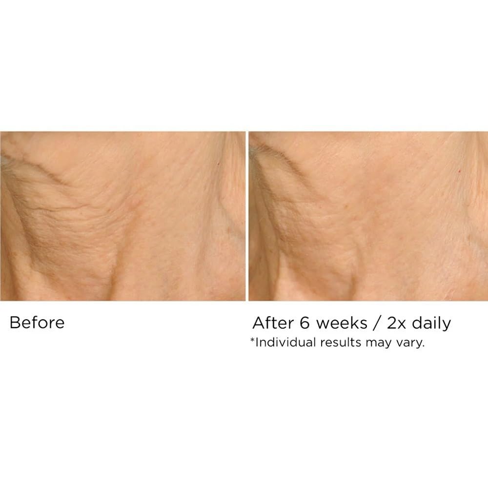 NASSIFMD lifestyle on bathroom vanity suggesting easy daily routine benefit