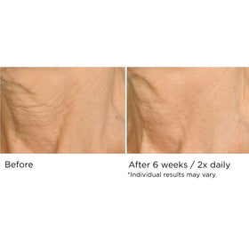 NASSIFMD lifestyle on bathroom vanity suggesting easy daily routine benefit