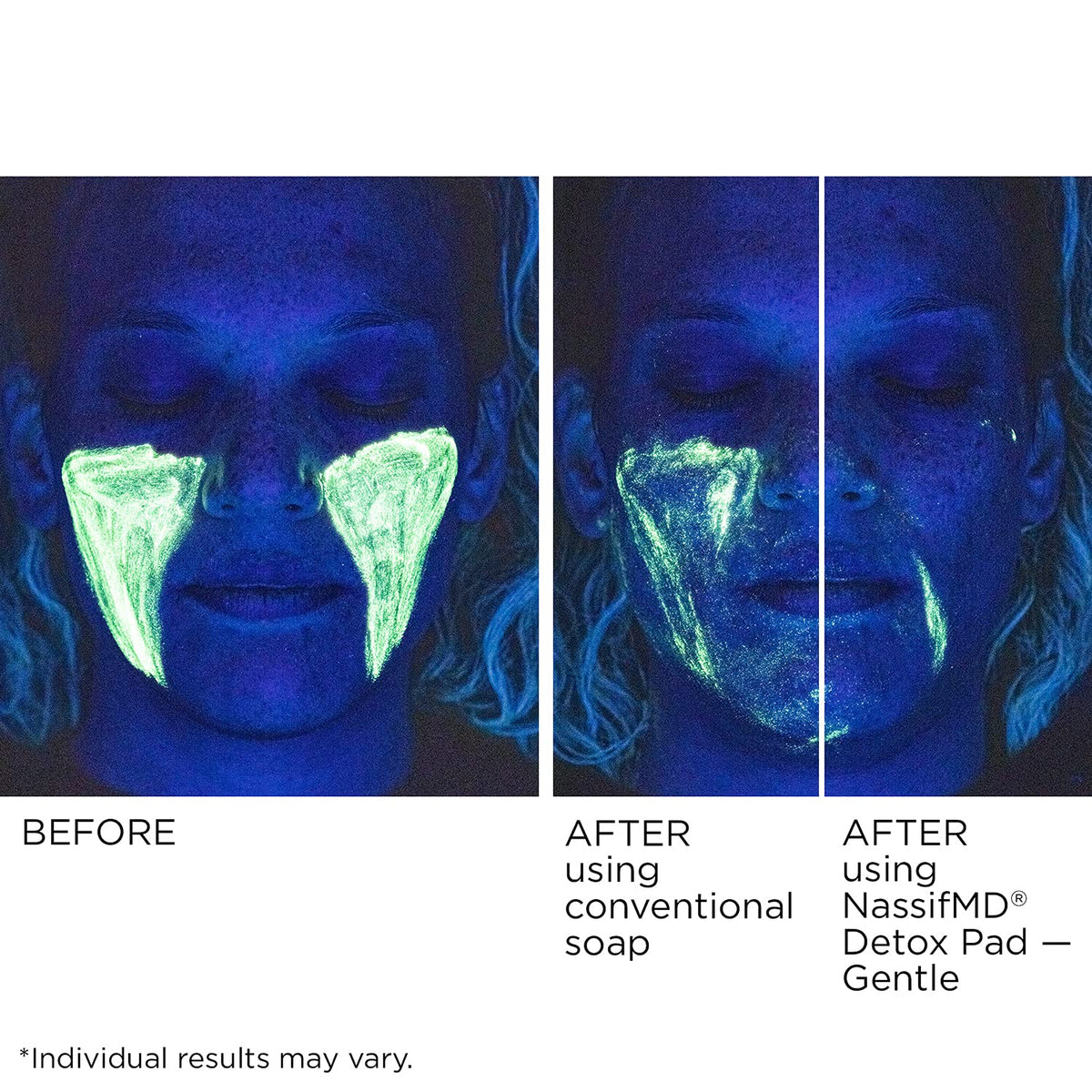 NassifMD ingredient display with vitamin C and hyaluronic acid benefits