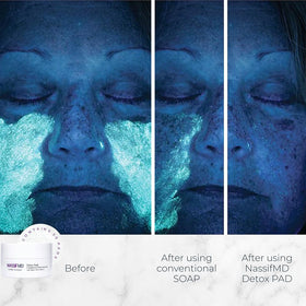 NassifMD pad close-up texture revealing smooth exfoliating surface benefit