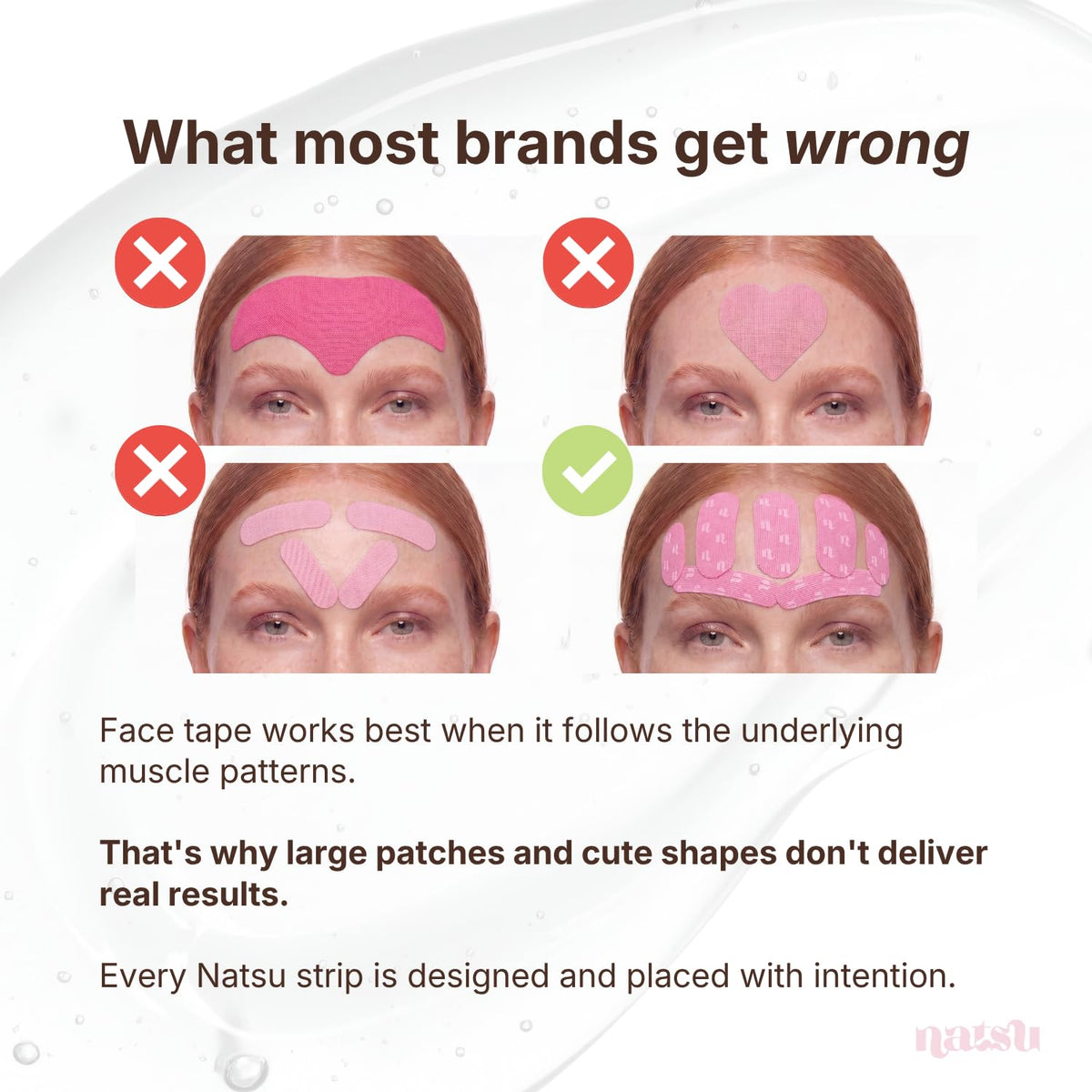 Natsu smile line patch close-up illustrating easy targeted placement