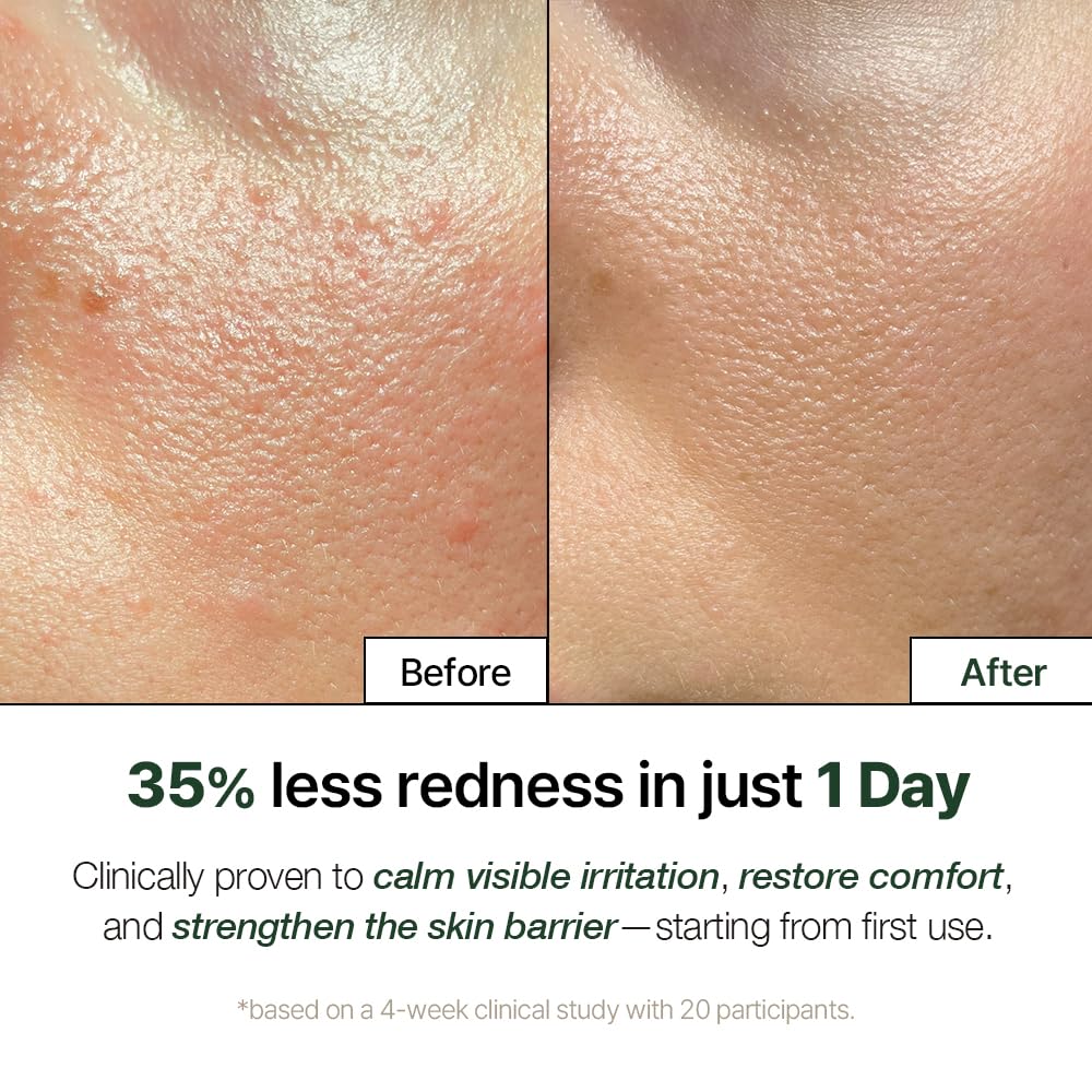 NATURAL DERMA PROJECT close-up of centella and bio-placenta ingredients for calming