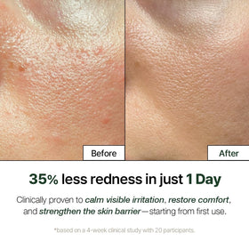 NATURAL DERMA PROJECT close-up of centella and bio-placenta ingredients for calming