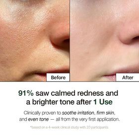 NATURAL DERMA PROJECT dispensing a pea-sized amount demonstrating easy controlled use