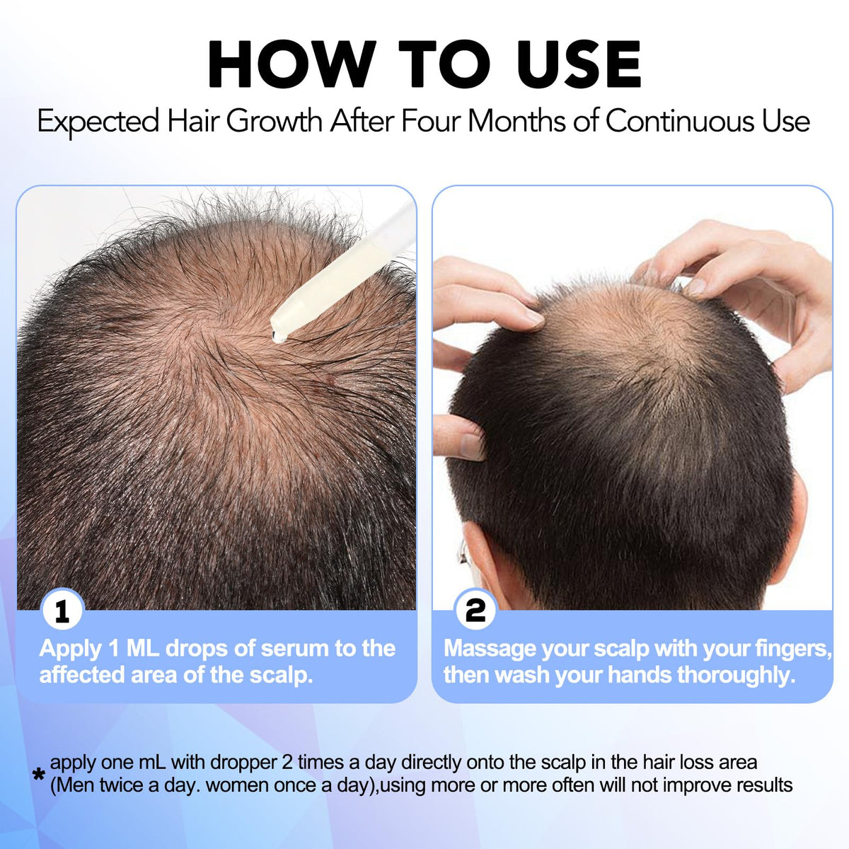 NATURE ZIRAN applied to scalp showing targeted treatment and coverage