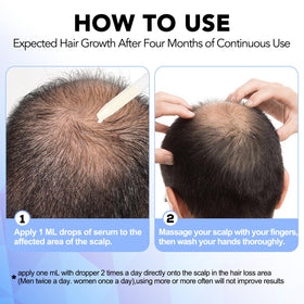 NATURE ZIRAN applied to scalp showing targeted treatment and coverage