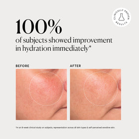 Naturium cream spread on hand demonstrating smooth application benefit