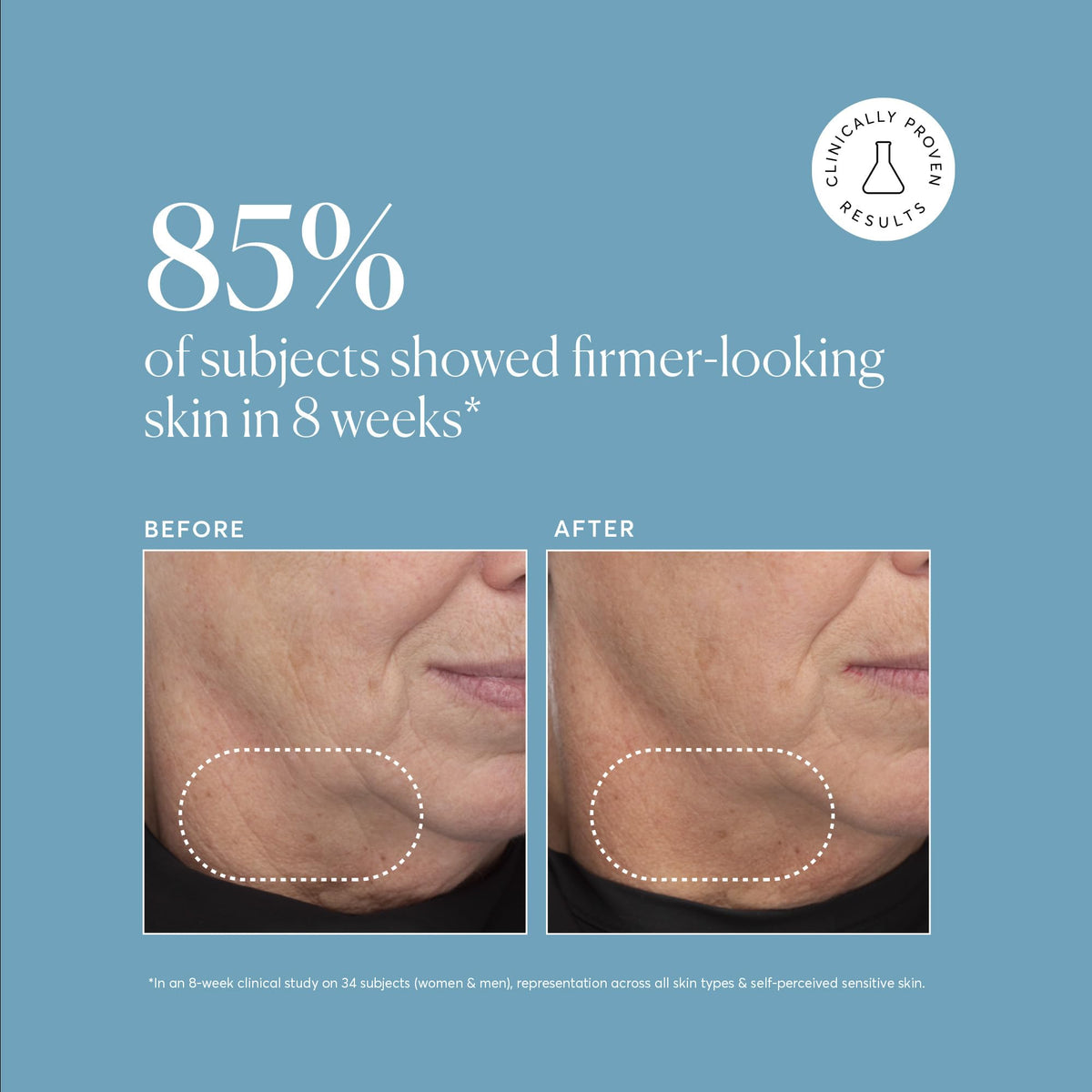 Hand applying Naturium retinol serum illustrating easy night routine benefit
