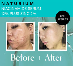 Naturium serum spread on skin demonstrating lightweight absorbency