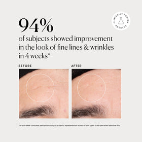 Naturium before-and-after visual suggesting smoother texture and firmer-looking skin