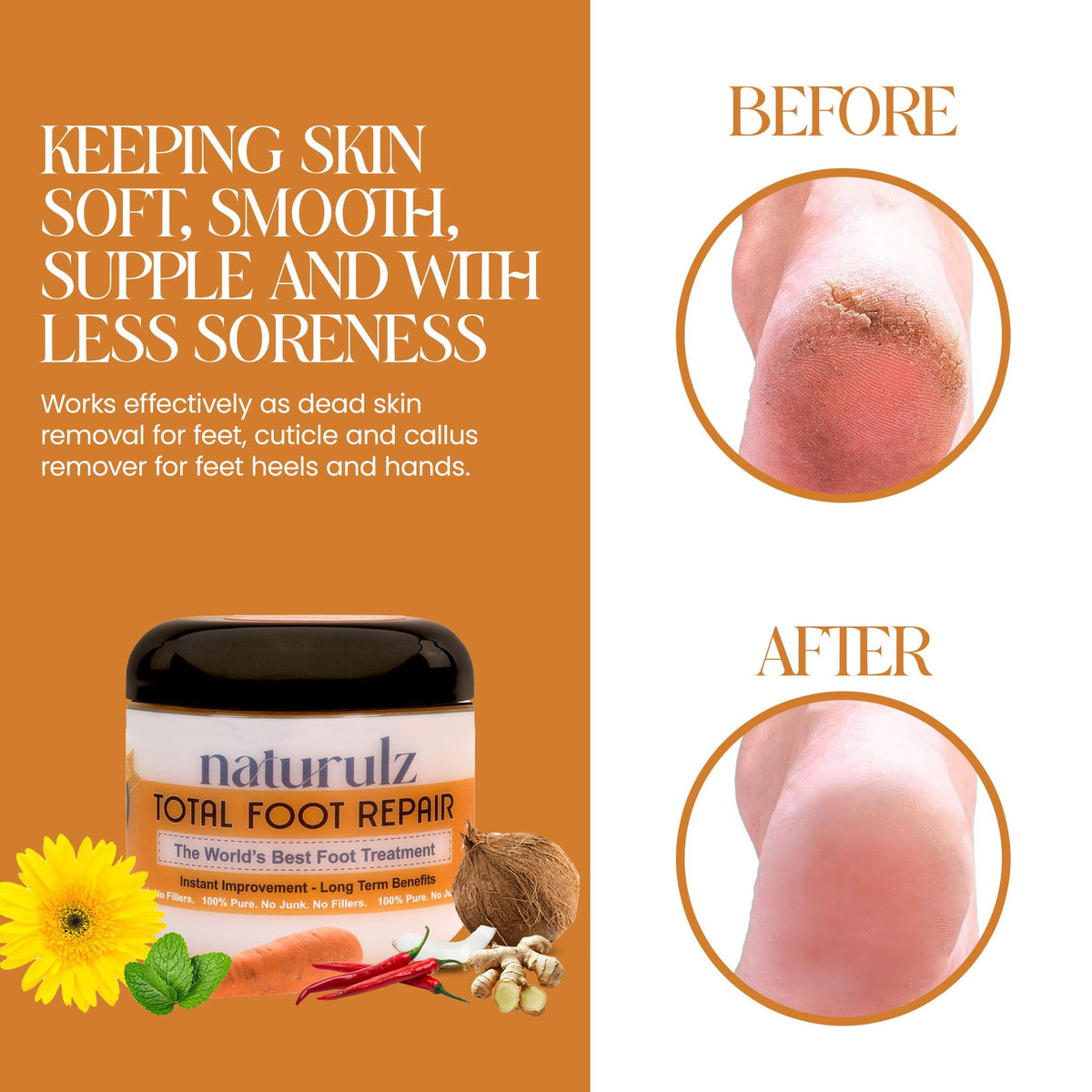 Naturulz being applied to a cracked heel for visible soothing