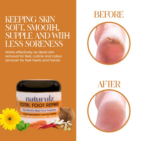 Naturulz being applied to a cracked heel for visible soothing