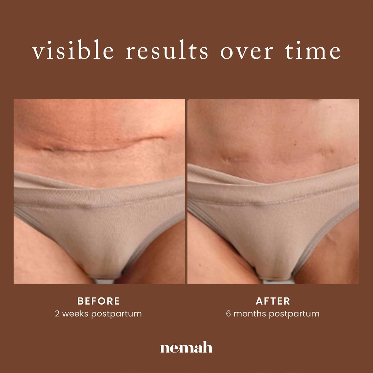 Nemah in postpartum bathroom routine showing convenient daily use benefit