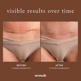 Nemah lifestyle postpartum scene, shows comfortable daily application benefit