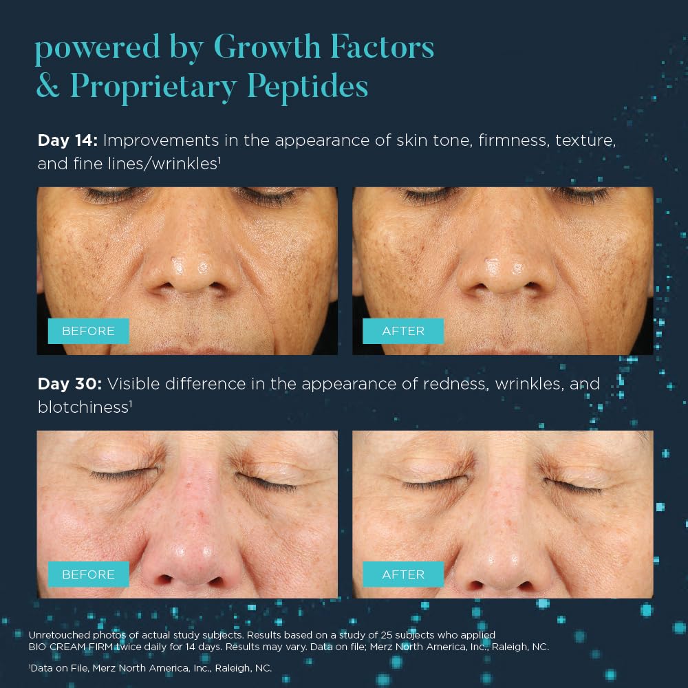 NEOCUTIS before and after texture improvement for smoother skin look