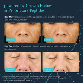 NEOCUTIS before and after texture improvement for smoother skin look