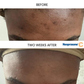 Neoprosone lightweight serum texture on skin absorbed for smooth finish
