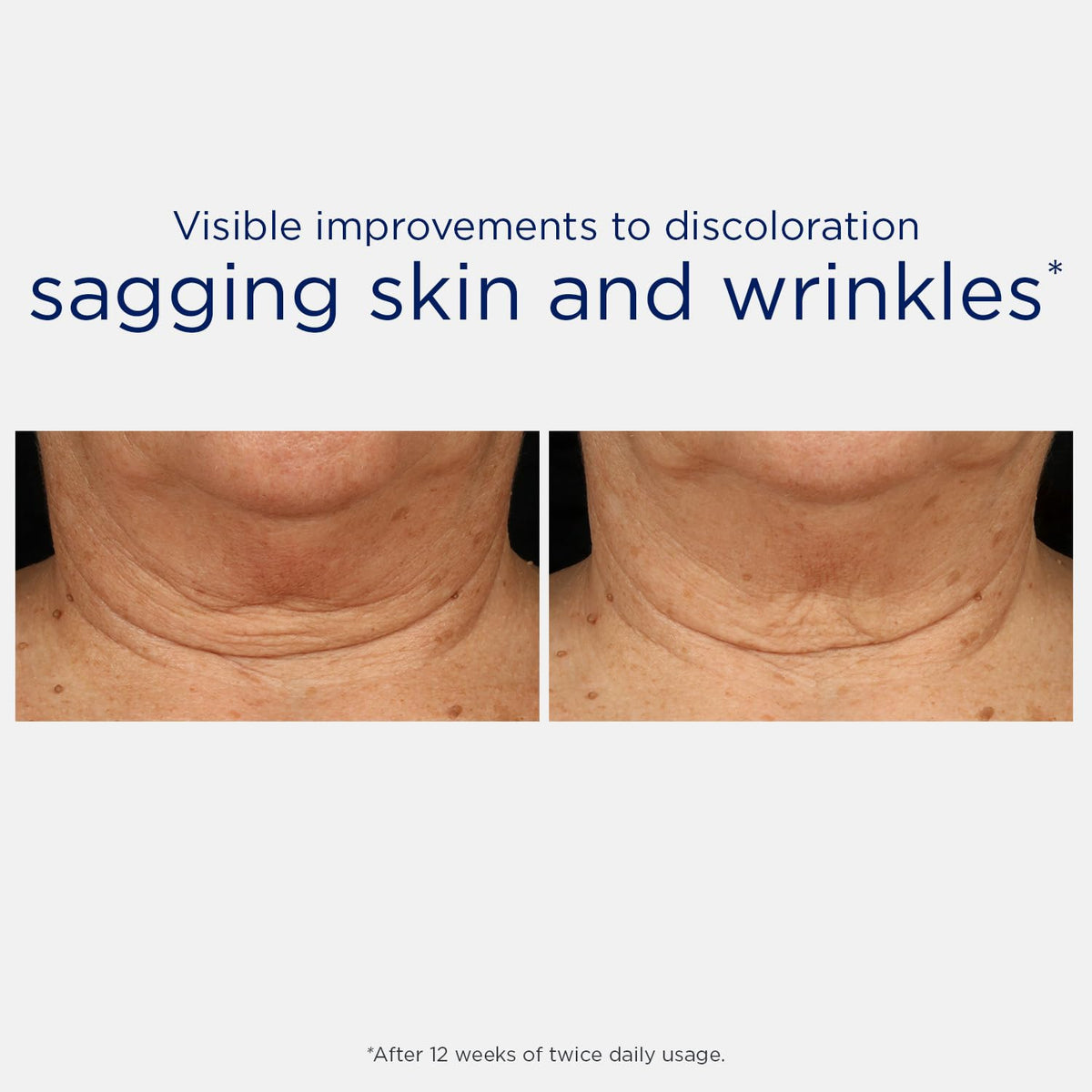 NEOSTRATA applied to neck showing smoothing effect in use